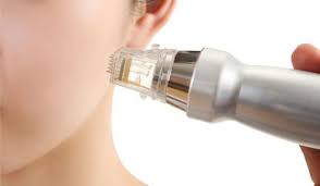 RF Fractional Microneedling RF Fractional Microneedling